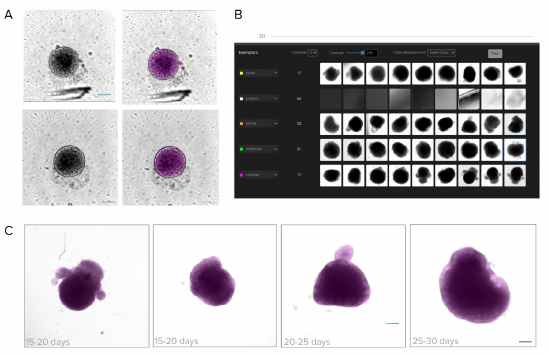 Organoides cerebrales 3D usando herramientas de análisis basadas en IA
