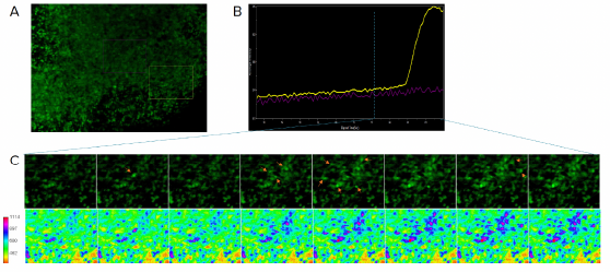 Adquisición de imágenes de calcio de organoides cerebrales para determinar la actividad neuronal