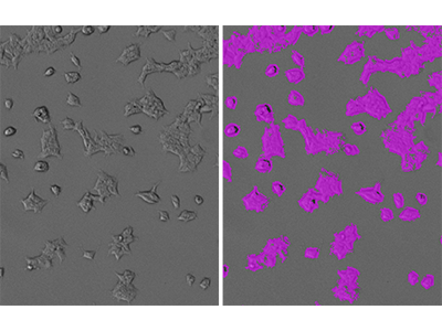 Identificación StainFree de células HEK293-GFP