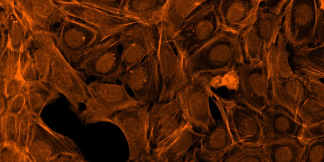 F-actin cytoskeleton, Golgi, plasma membrane Dye: Conjugado de faloidina/Alexa Fluor 568, conjugado de aglutinina de germen de trigo/Alexa Fluor 555