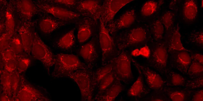Mitochondria -Dye: MitoTracker Deep Red