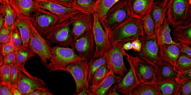 Imagen compuesta con rojo: actina y Golgi; verde: RE; y azul: núcleos