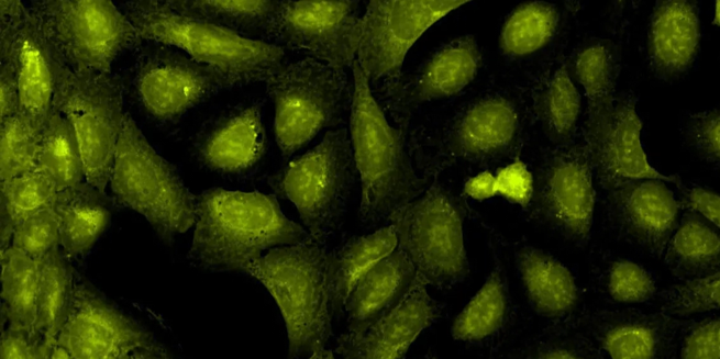 Nucleoli, cytoplasmic RNA -Dye: Tinción de ácidos nucleicos fluorescente verde SYT0 14