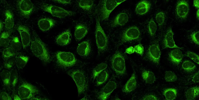 Endoplasmic reticulum -Dye: Conjugado de concanavalina A/Alexa Fluor 488