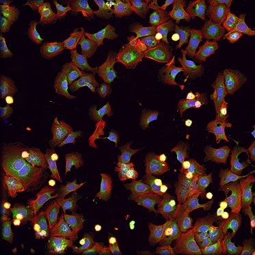 Cells treated with rotenone, a toxin frequently used in insecticides