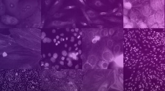 Recursion genera el conjunto de datos morfológicos celulares humanos más grande disponible públicamente para la investigación de tratamientos para la COVID-19