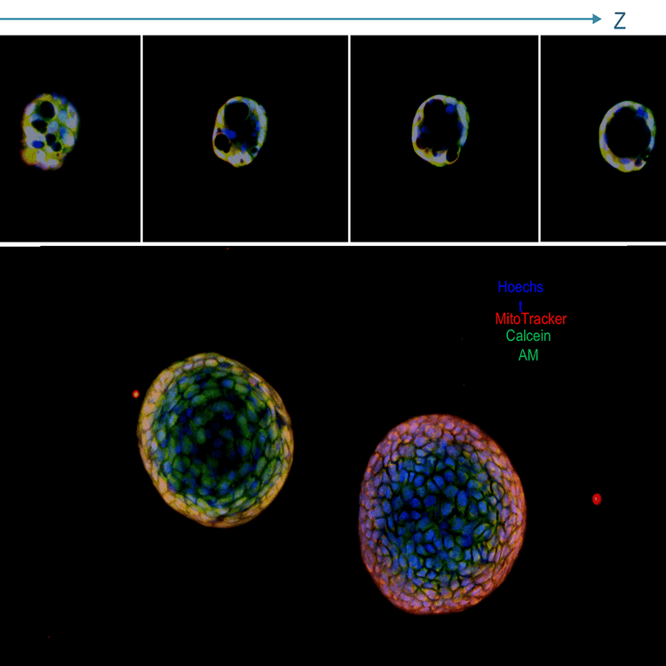 Solapamiento de daño en el ADN en células U2OS con el sistema ImageXpress Nano