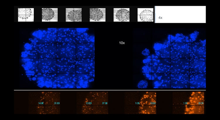 Adquisición automática de imágenes de organoides vivos en Matrigel, aumento 4X o 10X