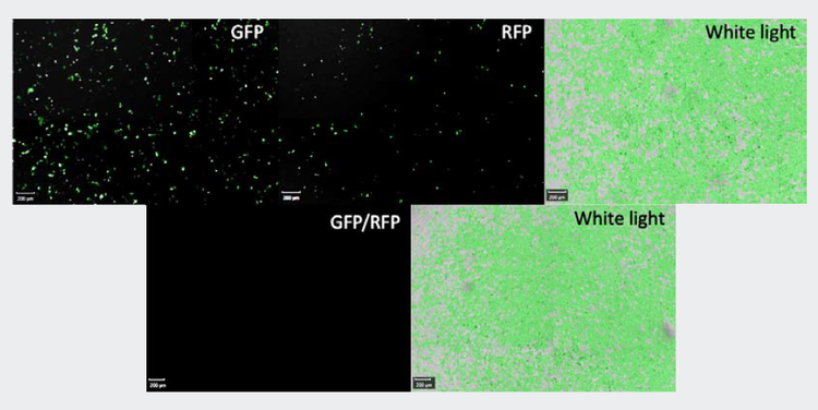 GFP (left), RFP (middle), and white light filters