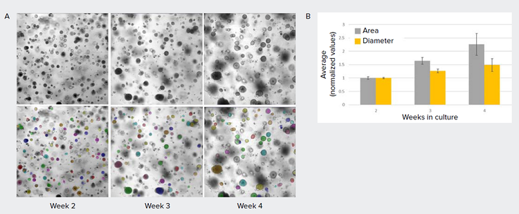 AI-based Method to Assess Growth of Lung Organoids