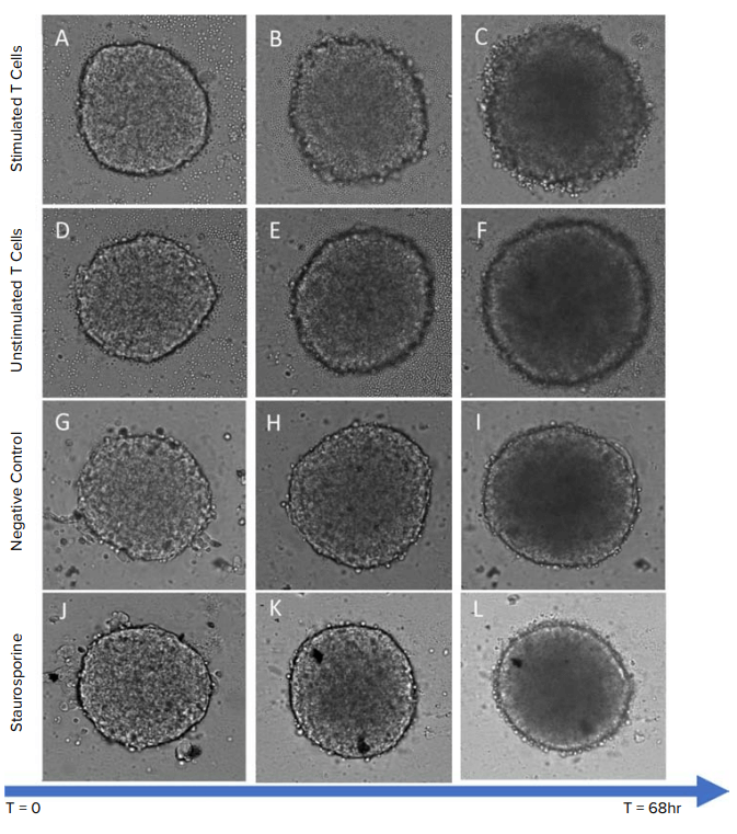 TL image of Hela spheroids treated with stimulated T cells