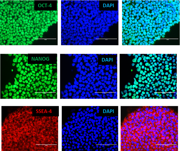 Las células iPS pluripotentes expresan marcadores de pluripotencia: Oct-4, Nanog y SSEA4