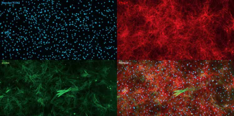 Imágenes adquiridas con el sistema de adquisición automática de imágenes celulares ImageXpress Pico de fibroblastos dérmicos cultivados aislados de piel de vaca. Núcleos (azul), colágeno (rojo) y actina-alfa de músculo liso (verde)