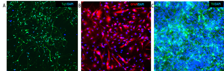 Derivadas de iPSC - Tuj1, GFAP y TH con tinción de contraste de núcleos con DAPI