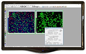 Software de automatización de microscopía y análisis de imágenes MetaMorph