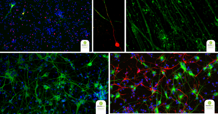 Uniones neuromusculares, cinética de mielinización y proliferación de células gliales