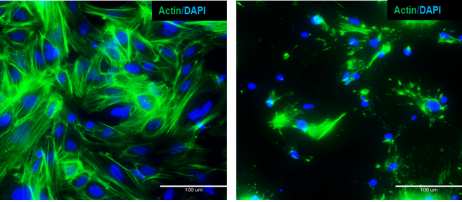 Alteración del citoesqueleto: hepatocitos derivadas de iPSC con tinción de actina de células no tratadas y tratadas con latrunculina