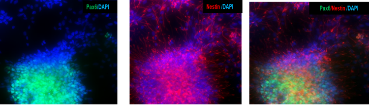 Las células progenitoras neuronales derivadas de iPSC expresan los marcadores progenitores neuronales PAX6 y nestina