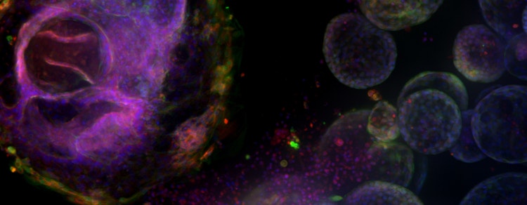 organoid models