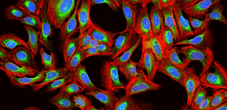 How Cell Painting is making its mark on drug discovery