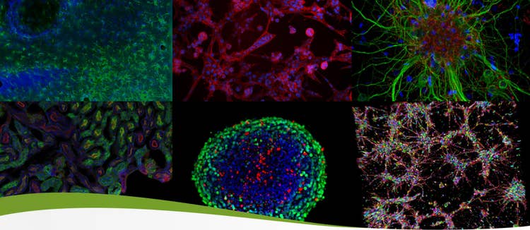 cloning and strain engineering