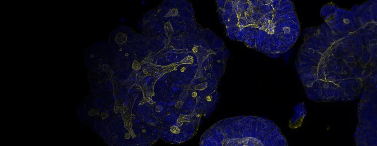 Organoids