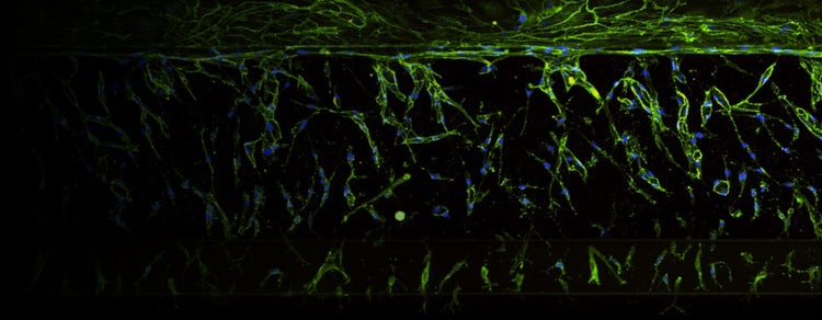 3D Disease Models