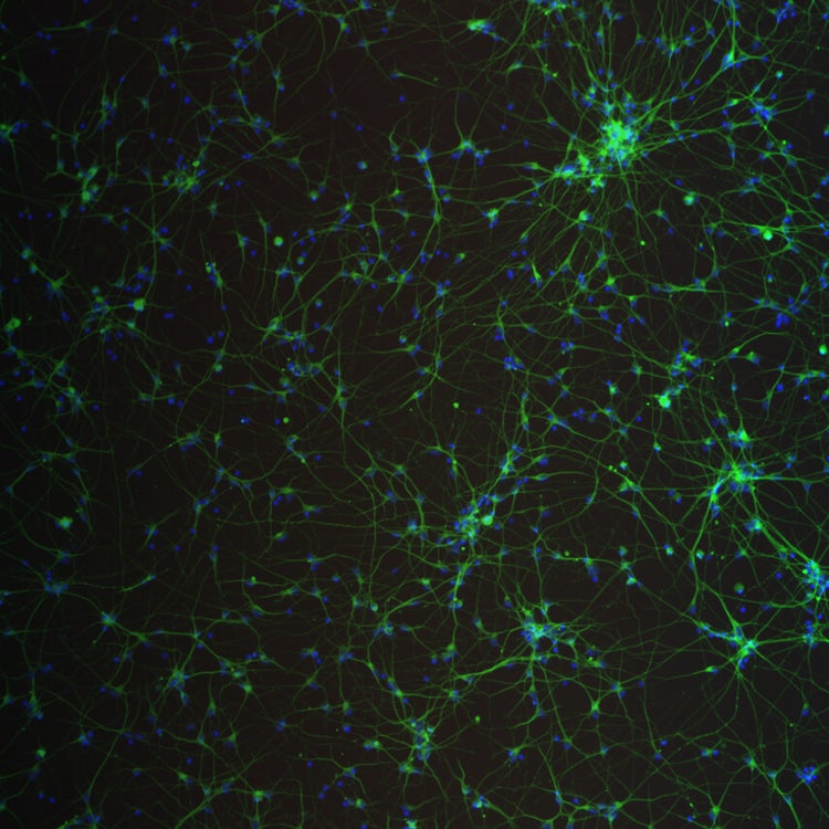 iPSC-derived Neuronal Cells