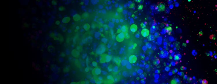 patient-derived tumoroids
