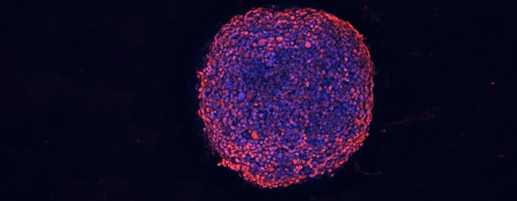 3D Imaging