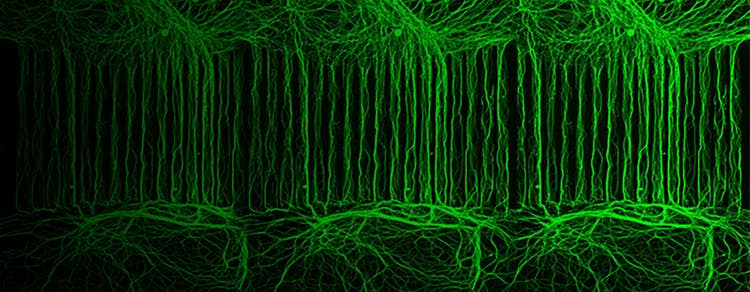 Ananda Neurite