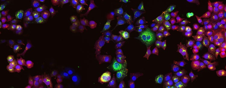 organoid assays