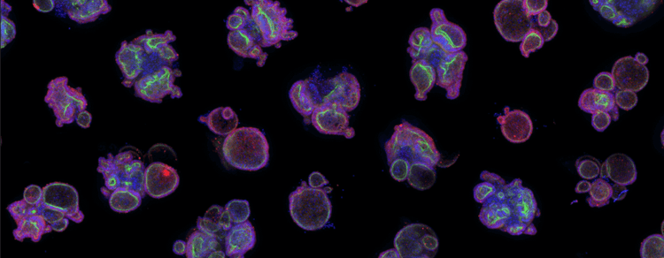 Organoid Culture