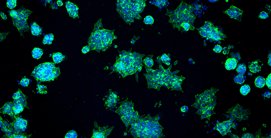 Esferoides de células cancerosas 3D