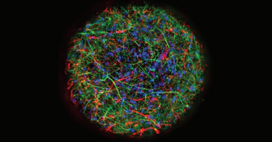 Oscilación de calcio en esferoides neuronales 3D