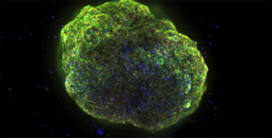 Organoides cardiacos o plataforma cardioide