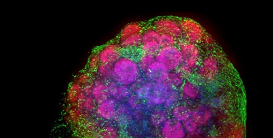 Organoides de cerebro (cerebrales, neurales) 3D