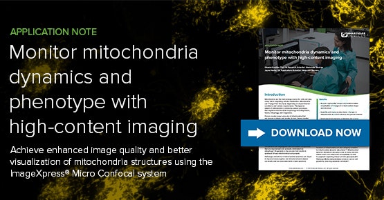 Monitorice la dinámica y el fenotipo de mitocondrias con la HCI