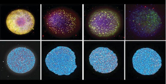 Neurotoxicidad, toxicidad neuronal