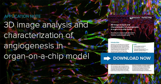 Análisis de imágenes 3D y caracterización de la angiogénesis