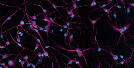 Células madre pluripotentes inducidas (iPSC)