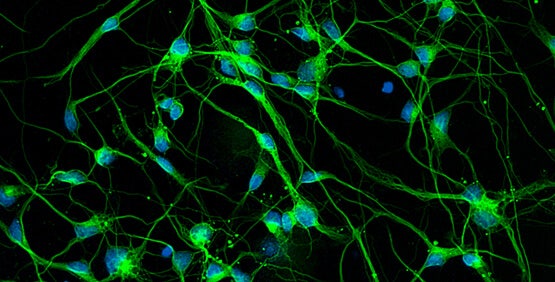 Morfología neuronal