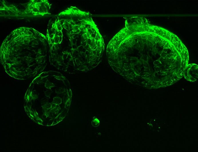 Organoide frente a esferoide