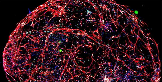 Microtejidos cerebrales