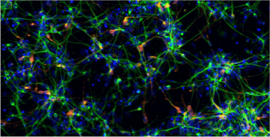 Neuronas, crecimiento axonal