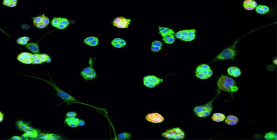 Las células se cultivan en una matriz extracelular (MEC) para recrear un entorno in vivo.