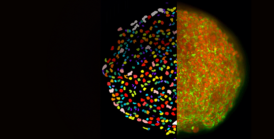 Ensayos 2D y 3D con células, de alta complejidad e iluminación láser