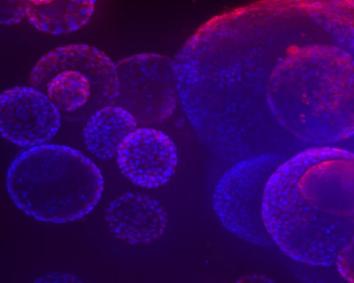 Organoides 3D