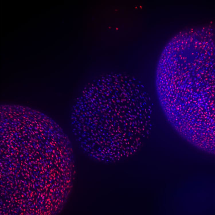 imagen de organoide de ImageXpress Confocal HT.ai usando In Carta
