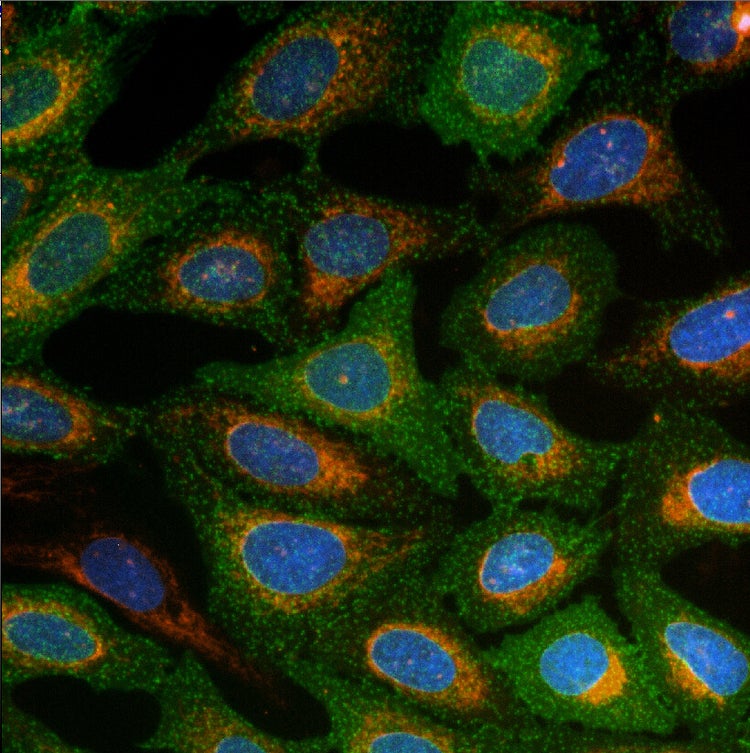 Tecnología AgileOptix para ImageXpress Micro Confocal